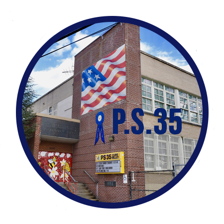 PS35